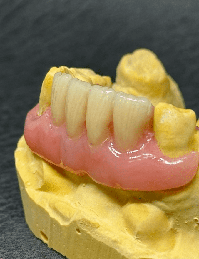 Laboratorio Biosque Dental protesis